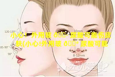 小心！外用玻 🌷 尿酸可能伤皮肤(小心!外用玻 💮 尿酸可能伤皮肤)